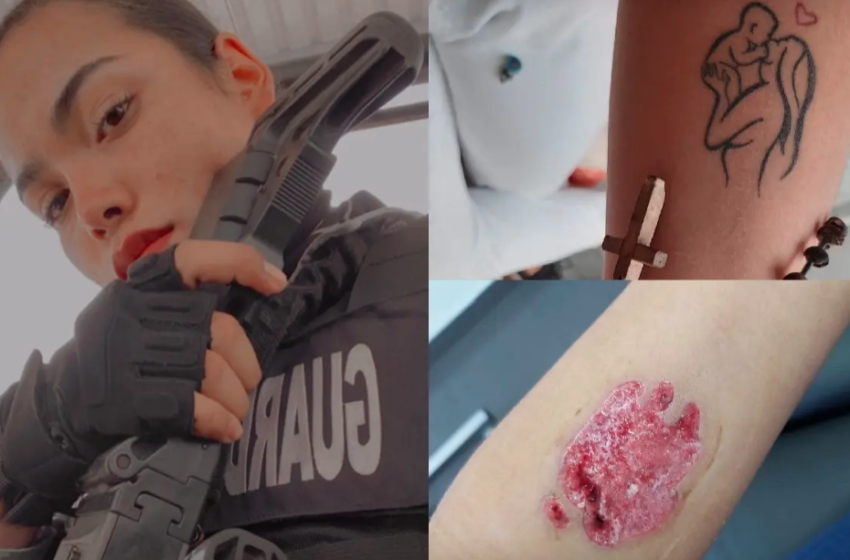  MUJER TUVO QUE RETIRARSE TATUAJE PARA PODER INGRESAR A LA MARINA.